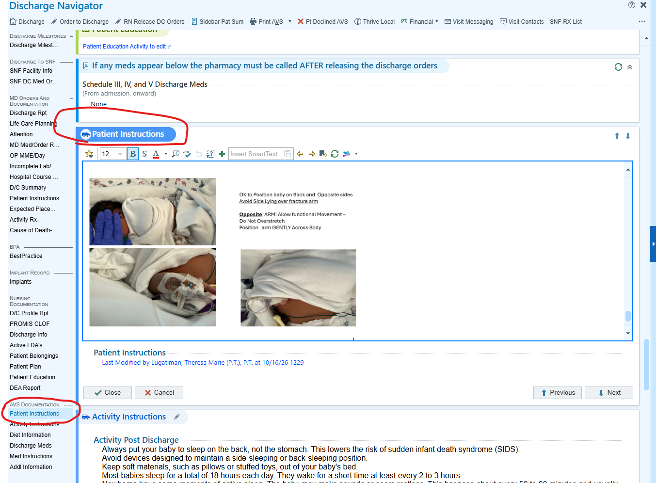 Adding .humerusfx in the Patient Instructions section of the Discharge Navigator.