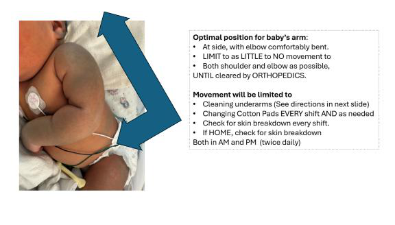 Optimal position for baby’s arm (NICU PT).